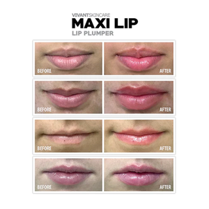 Vivant Maxilip Lip Plumper