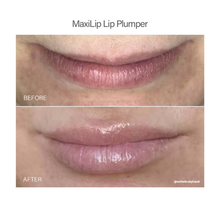 Load image into Gallery viewer, Vivant Maxilip Lip Plumper
