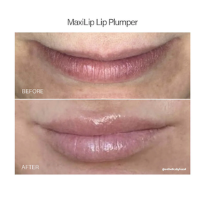 Vivant Maxilip Lip Plumper